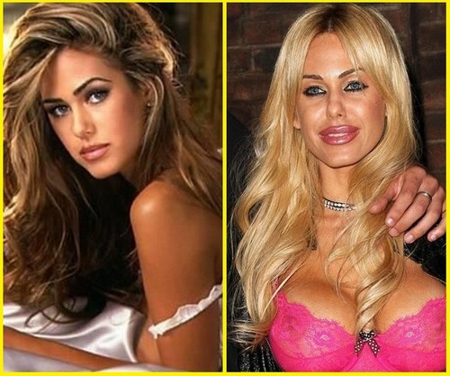 16-shauna-sand-plastic-surgery-before-and-after_tn.jpg
